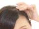 does evolis prevent hair loss
