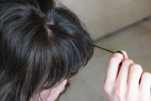 trichotillomania hair pulling