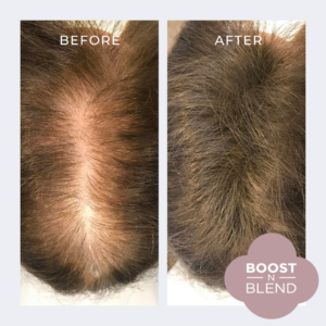 Cover up female hair loss with boost n blend